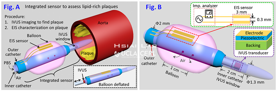 Intravascular deployment of the integrated EIS sensor 
And IVUS transducer to assess lipid-laden plaques, Tzung Hsiai Lab
